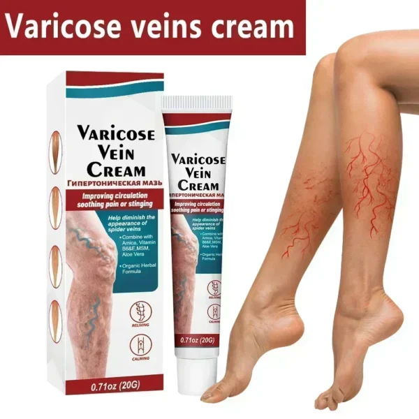 100%original vasculitis blood circulation varicose veins treatment new cream