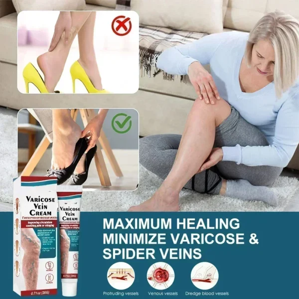 100%original vasculitis blood circulation varicose veins treatment new cream